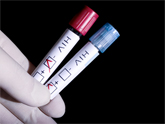 Mandatory testing flawed